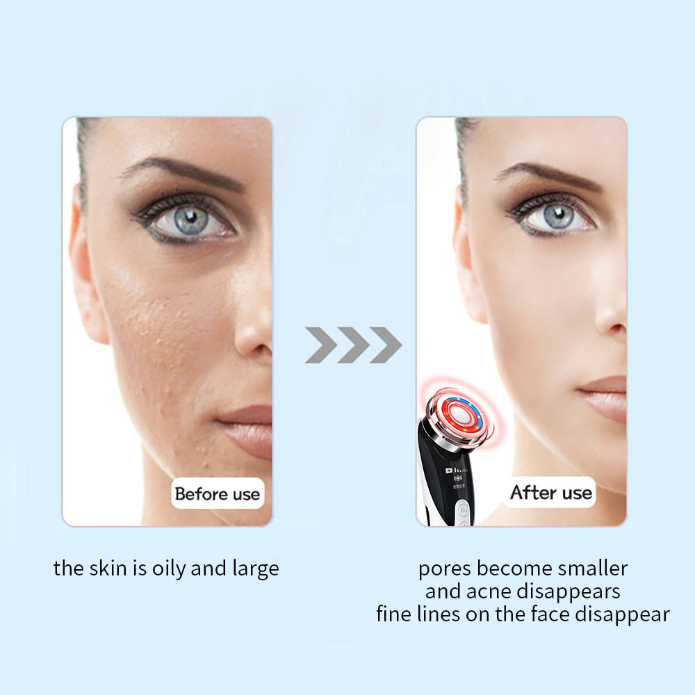 RejuvaLift Pro LED Skin Rejuvenator - 5-in-1 Facial Care System